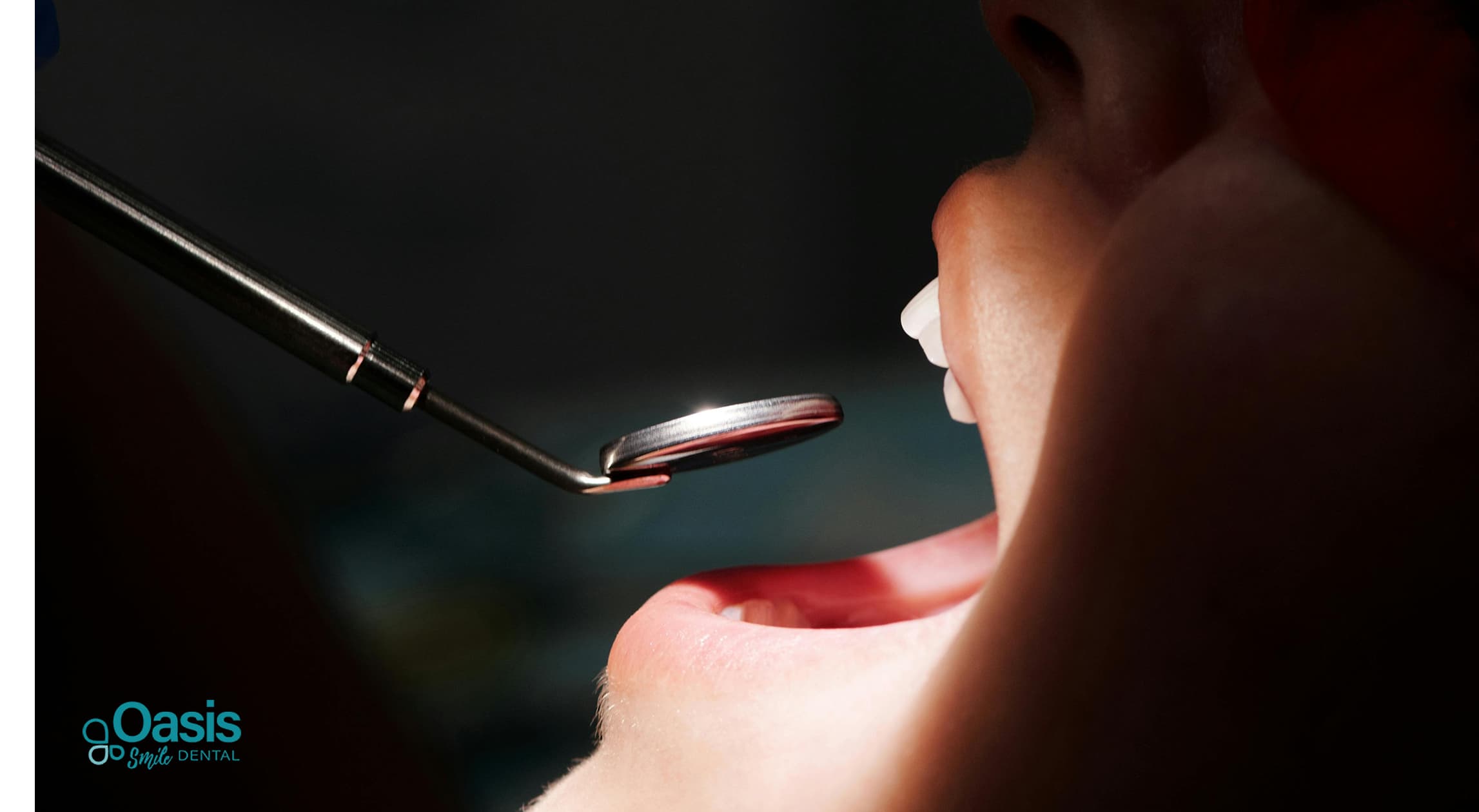 Same-Day Dental Crowns: How This Treatment Can Restore Your Smile Faster